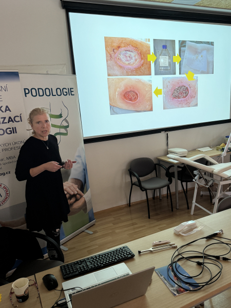 Pedikérská péče o rizikovou nohu u diabetika